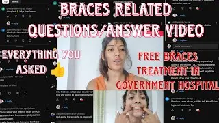 Free braces treatment in Government hospital/Questions answer video😉🏥#braces #bracesupdate #dentist