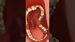 ASMR Remove debris from ears and teeth #asmr #shorts #animation