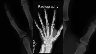 World Radiography Day 2024 /nov 8/#rtnandhusworld
