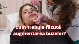 Cum trebuie realizata augmentarea buzelor? | DermaBeauty Clinique