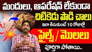 Dr Srinivas - పైల్స్/మొలలు పూర్తిగా పోతాయి.! | How To Get Relief From Piles In 10 Days | iDream