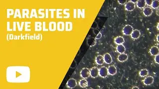 Parasites in Live Blood - Darkfield