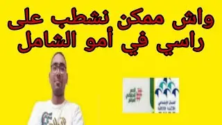 واش ممكن نشطب على راسي في أمو الشامل ؟