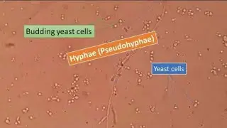 Microbiology 🔤 - KOH Wet Mount