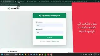 BoneXpert detection system