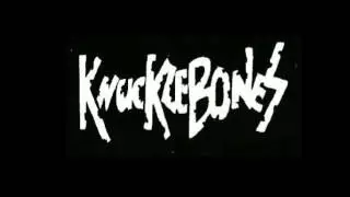 Rock Against MS UK - Winterfest Preview
