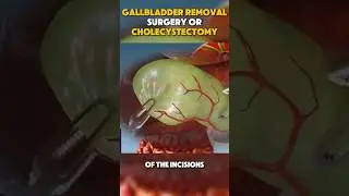 #healing #dentist #health #dentalclinic #selfcare #dentistry #therapy #therapyvideos #veneers