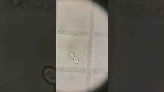 yeast cell in  beer fermentation