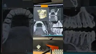 Taking a CBCT #cbct #digitaldentisty #dentist #dentalimaging #conebeam #science #dentalartistry