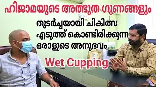 Amazing Benefits of Hijama (Treatment), 
