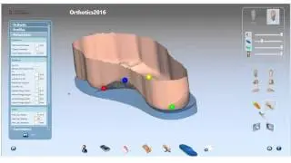 Autodesk OrthoModel 2016 - Alignment points, Cross section and Arch Fit