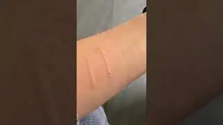 Cat aggressively bites owner and then says sorry  #cat  #cats #shorts