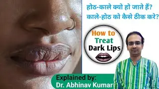 dark lips treatment by dermatologist | how to treat dark lips dermatologist| dark lips removal cream