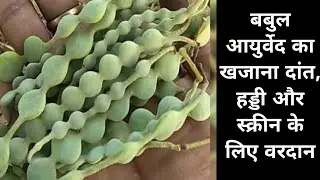 Ayurvedic Benefits of Babool Babul pods are more valuable than treasure