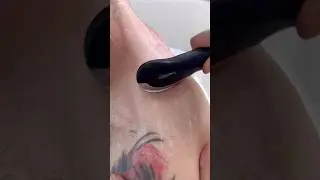 Achedaway heated scraper and Cupper works perfectly with manual therapy to amplify its effects.
