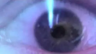 Tripeye.mov