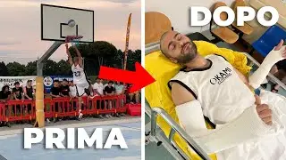 Mi sono ROTTO le BRACCIA || JASER