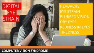 Eye Strain Relief  | Long Working on Computer Screen | Screen time | Headache | Fatigue