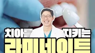 [부평치과-해피스치과] 웃을 때마다 신경 쓰이던 앞니..라미네이트로 자신감 되찾자!✨