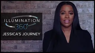 Jessica Rich's Dermal Filler Transformation Journey at Mabrie Facial Institute in San Francisco