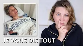 MON OPÉRATION : je vous explique tout !
