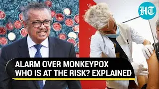 Monkeypox a sexually transmitted disease? Know how it spreads and preventive measures