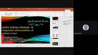 مبادئ الطب والجراحة-Cystic kidney disease & Congenital abnormalities Of urinary tract - الدكتور ضياء