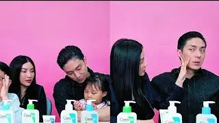 Papio bilang ke Mamio sedih gara gara flek di wajah 