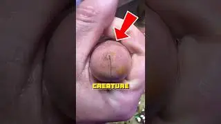 NEVER Touch This Creature ‼️