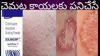 Clocip powder uses in telugu| best for the fungal infections|dusting powder| clotraimaxazole powder