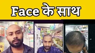 Face के साथ  | hair lotion | hair serum | hair treatment | head shave | scalp