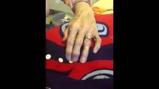 Putting buttons on a button blanket