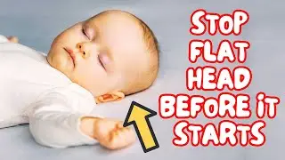 STOP Flat Head Syndrome Before It Starts 👶 Newborn Head Shape Tips