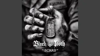 Scars