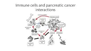 Immune cells and pancreatic cancer cells interactions #Code: 1031