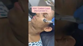 Carbon laser treatment | Laser face treatment | Carbon facial