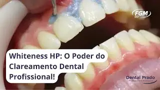 Guia Completo do Whiteness HP: Clareador Dental com Per&oacute;xido de Hidrog&ecirc;nio