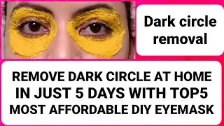 Remove dark circles at home in just 5 days with top5 most  affordable DIY EYEMASK | RARA