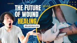 The Future of Wound Healing | Implantable Chips and Artificial Skin
