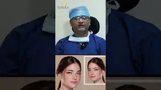 Does nose size increase with age? Watch this!!!