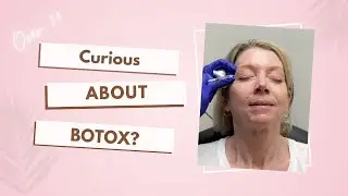My Experience With BOTOX - Over 50