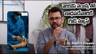 Advanced Laser Treatment for Varicose Veins | Avis Hospital Hyderabad