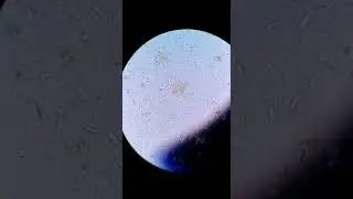 Giardia lambia/ Falling leaf motility/saline wet mount