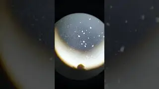 Observation micro faune au microscope.