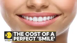 The Good Life: Decoding the 'Turkey teeth' trend