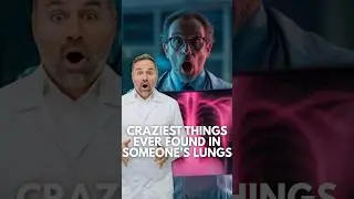 ЧТО врачи обнаружили в своих лёгких?! (Три самых безумных случая)