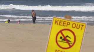 Tijuana River sewage is causing a range of health issues, doctors say