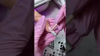 Че делать с пузырем😱