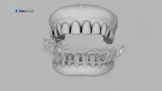 Our Clients Video- Teeth Braces| learn digital marketing