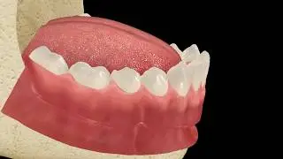 Fixing Loose Dentures - Weston, WI - Dr. Jan Bublik